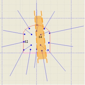 Detecting  - 5